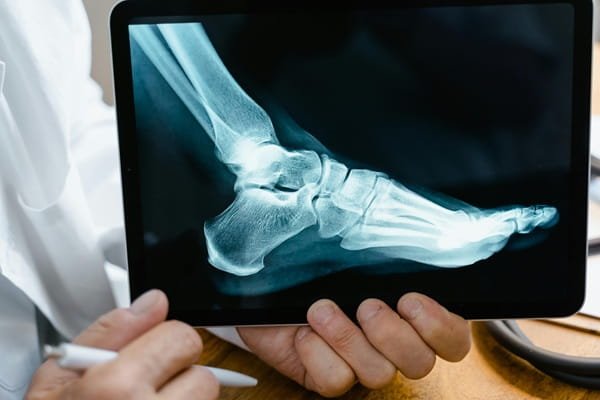injury